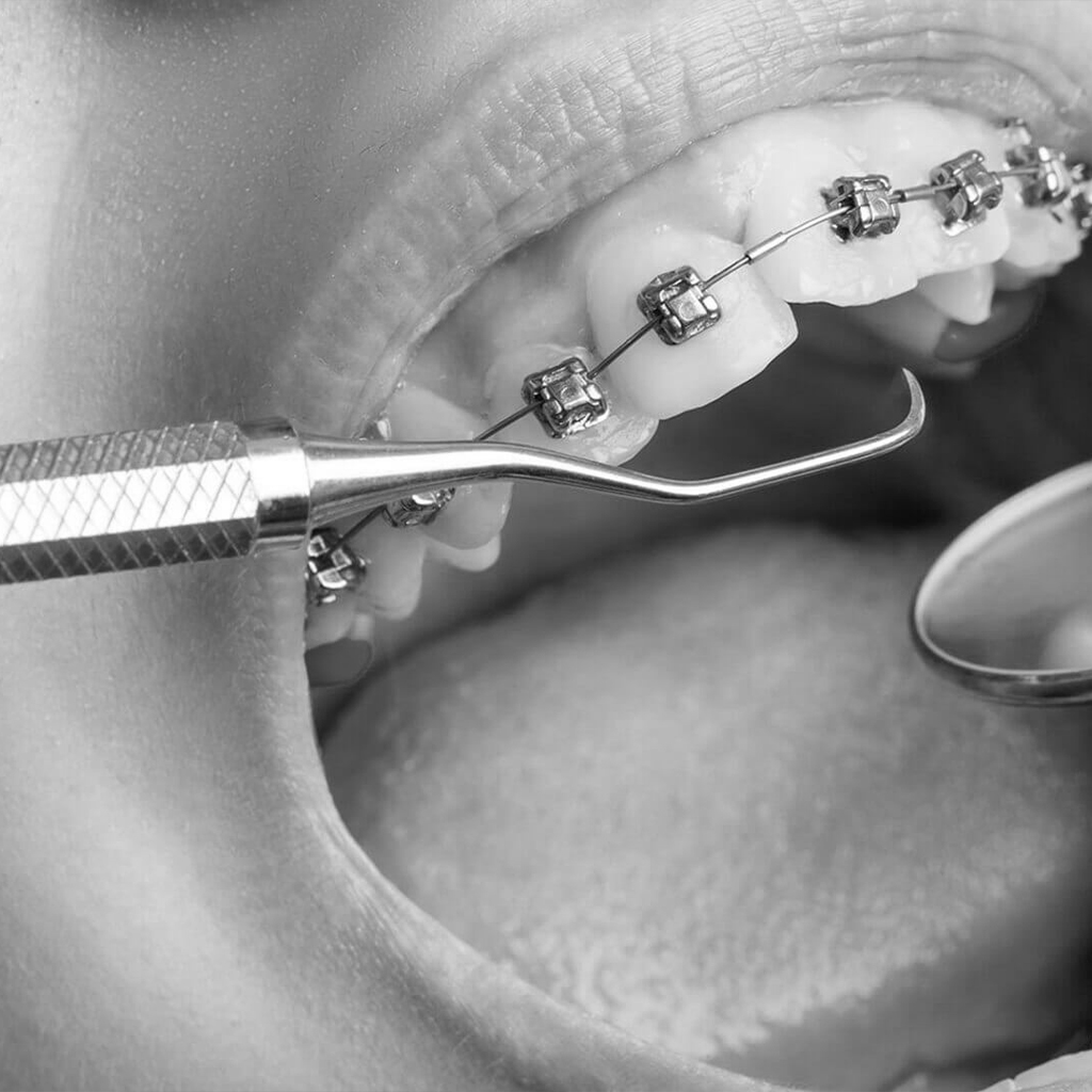 Ortodonti İncek Dentaltun Ağız ve Diş Sağlığı Polikliniği